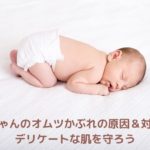 赤ちゃんのオムツかぶれの原因&対策!デリケートな肌を守ろう