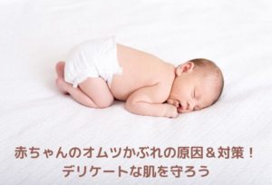 赤ちゃんのオムツかぶれの原因&対策!デリケートな肌を守ろう
